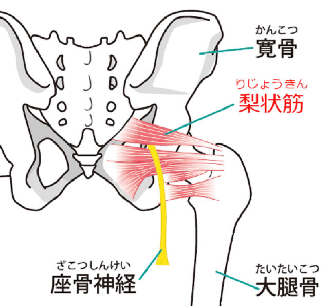 梨状筋